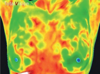Ohne Angst vor Krebs: Infrarot Mamma-Screening