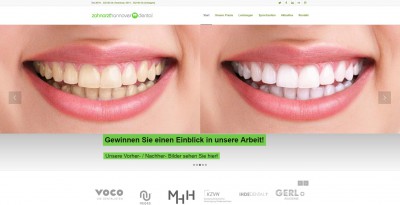 Six Month Smiles - Die neue Behandlung für gerade Zähne