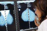 Mammographie-Screening in Deutschland auf sehr gutem Weg