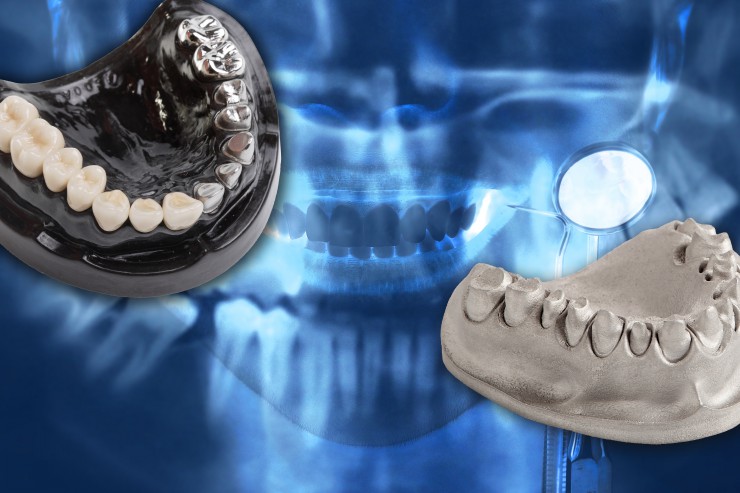 Voll im Trend: SLM Solutions zeigt Einsatzmöglichkeiten der additiven Fertigungstechnologie und neue Werkstoffe auf der IDS 2015 in Köln