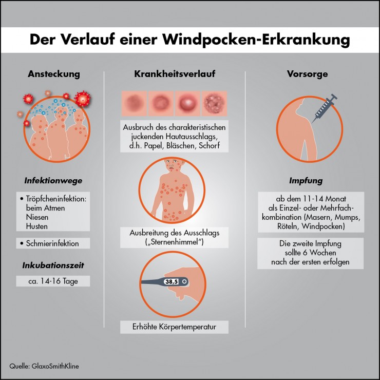 Windpocken: Zahl der Erkrankungen immer noch zu hoch