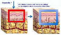 Objektiv überprüfbare Verbesserungen bei Cellulite und Hautfalten