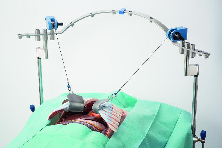 ulrich medical präsentiert neues Video: Seilzugretraktor für präzise Anwendungen in der Viszeralchirurgie